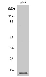 CD58 Polyclonal Antibody – Figure 1 of 1