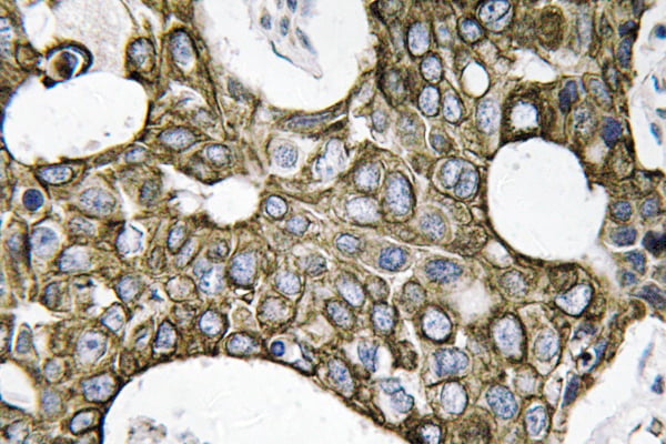 CD55 Polyclonal Antibody – Figure 1 of 1
