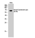 CD56 Polyclonal Antibody – Figure 1 of 1