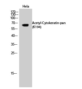 CD56 Polyclonal Antibody – Figure 1 of 1
