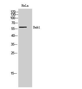 CD6 Polyclonal Antibody – Figure 1 of 1