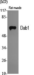 CD6 Polyclonal Antibody – Figure 1 of 1