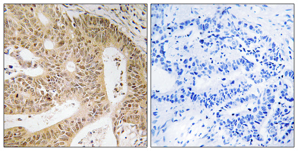 CD55 Polyclonal Antibody – Figure 1 of 1