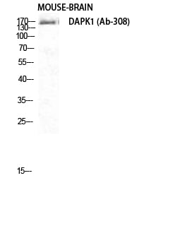 CD56 Polyclonal Antibody – Figure 1 of 1
