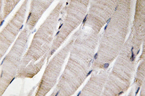 Defensin  Alpha3 Polyclonal Antibody – Figure 1 of 1