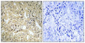 DHA Kinase Polyclonal Antibody – Figure 1 of 1