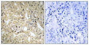 DHA Kinase Polyclonal Antibody – Figure 1 of 1