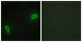 Dok-7 Polyclonal Antibody – Figure 1 of 1