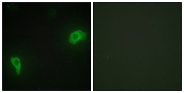 Dok-7 Polyclonal Antibody – Figure 1 of 1