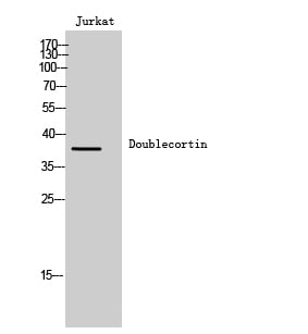 Doublecortin Polyclonal Antibody – Figure 1 of 1
