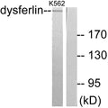Dysferlin Polyclonal Antibody – Figure 1 of 1