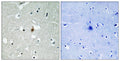 E2A Polyclonal Antibody – Figure 1 of 1