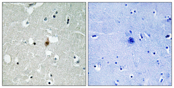 E2A Polyclonal Antibody – Figure 1 of 1