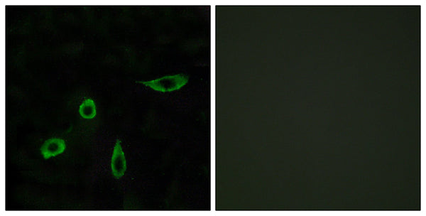 EDG-4 Polyclonal Antibody – Figure 1 of 1