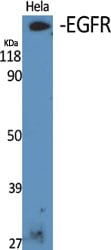 EGFR Polyclonal Antibody – Figure 1 of 1