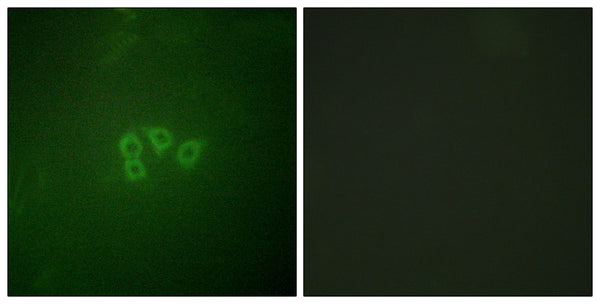 eIF4B Polyclonal Antibody – Figure 1 of 1
