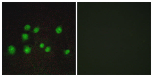 Elongin A2/3 Polyclonal Antibody – Figure 1 of 1