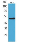 EMMPRIN Polyclonal Antibody – Figure 1 of 1