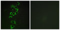 ErbB-4 Polyclonal Antibody – Figure 1 of 1