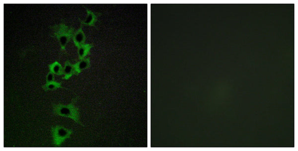 ErbB-4 Polyclonal Antibody – Figure 1 of 1