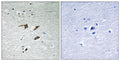 FAK Polyclonal Antibody – Figure 1 of 1