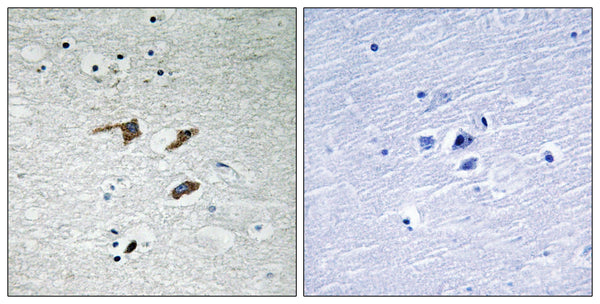 FAK Polyclonal Antibody – Figure 1 of 1