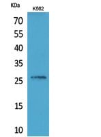FGF-16 Polyclonal Antibody – Figure 1 of 1