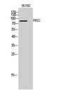 FRS2 Polyclonal Antibody – Figure 1 of 1