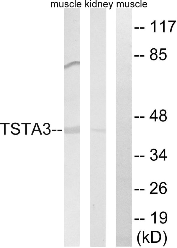 FX Polyclonal Antibody – Figure 1 of 1