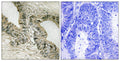 Gab 2 Polyclonal Antibody – Figure 1 of 1