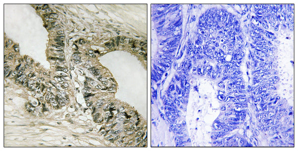Gab 2 Polyclonal Antibody – Figure 1 of 1
