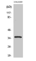 Galectin-4 Polyclonal Antibody – Figure 1 of 1