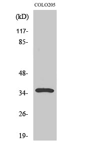 Galectin-4 Polyclonal Antibody – Figure 1 of 1