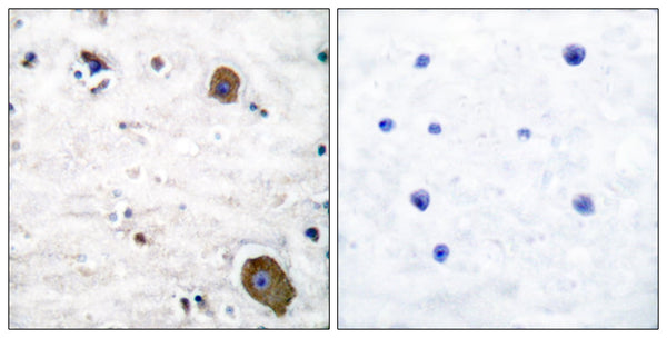 GFR Alpha-1 Polyclonal Antibody – Figure 1 of 1