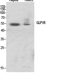 GLP-1R Polyclonal Antibody – Figure 1 of 1
