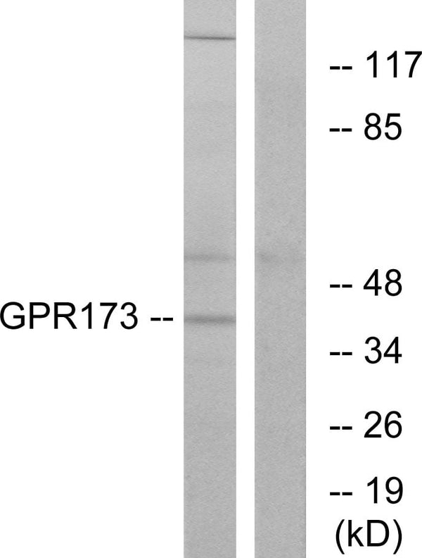 GPR173 Polyclonal Antibody – Figure 1 of 1