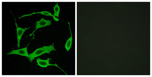 GPR85 Polyclonal Antibody – Figure 1 of 1