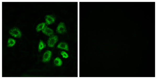 GPRC5B Polyclonal Antibody – Figure 1 of 1