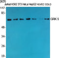 GRK 5 Polyclonal Antibody – Figure 1 of 1