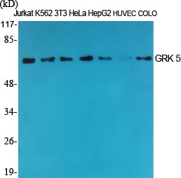 GRK 5 Polyclonal Antibody – Figure 1 of 1