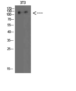 Hamartin Polyclonal Antibody – Figure 1 of 1