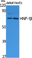 HNF-1Beta Polyclonal Antibody – Figure 1 of 1