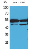 HNF-4 Alpha/Gamma Polyclonal Antibody – Figure 1 of 1