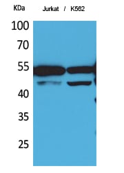 HNF-4 Alpha/Gamma Polyclonal Antibody – Figure 1 of 1