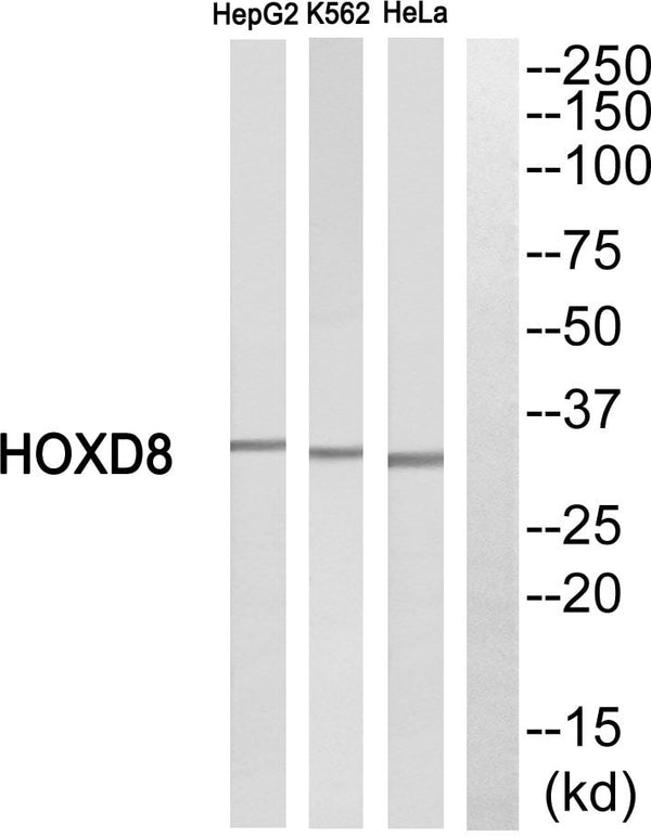 HoxD8 Polyclonal Antibody – Figure 1 of 1