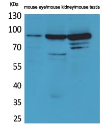 Hrs Polyclonal Antibody – Figure 1 of 1