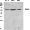 ICAM-1 Polyclonal Antibody – Figure 1 of 1
