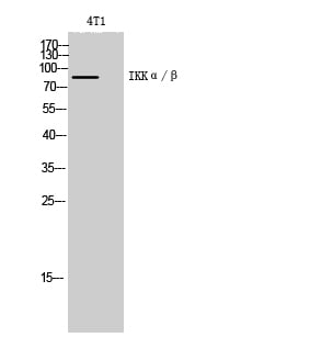 IKK Alpha/Beta Polyclonal Antibody – Figure 1 of 1
