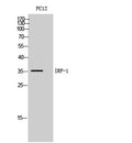 IRF-1 Polyclonal Antibody – Figure 1 of 1