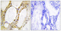 IRF-2 Polyclonal Antibody – Figure 1 of 1